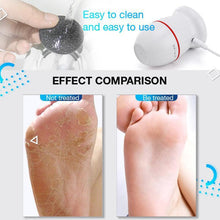 Load image into Gallery viewer, Electric Foot Scrubber for Cracked Heels and Dead Skin(THE BEST GIFT)