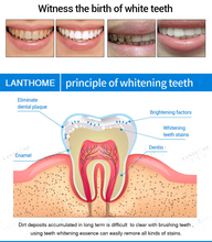 Load image into Gallery viewer, ✨50% off Last day Promotion✨FLAWLESS TEETH WHITENING PEN
