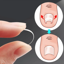 Load image into Gallery viewer, Paronychia Treatment Patch[40PCS+Tool]
