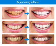 Load image into Gallery viewer, ✨50% off Last day Promotion✨FLAWLESS TEETH WHITENING PEN

