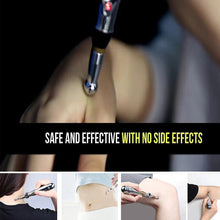 Load image into Gallery viewer, Electronic Acupuncture Pen
